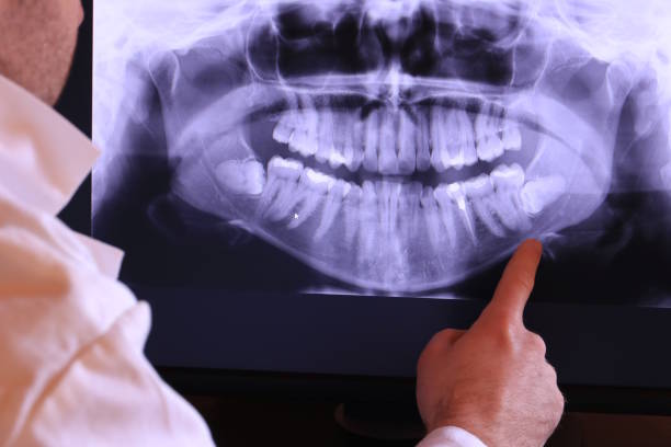 Best Same-Day Emergency Dentist in Monahans, TX
