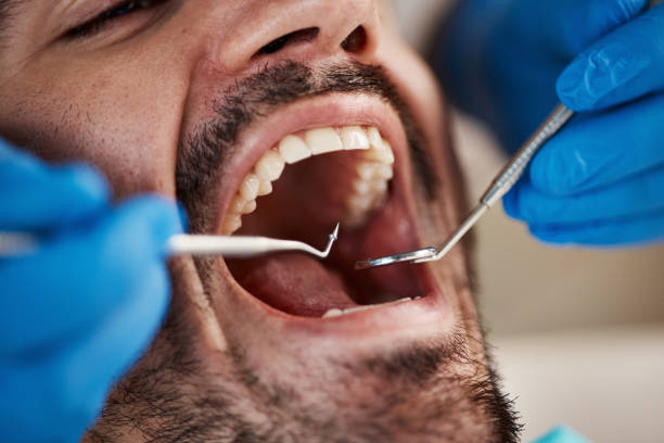 Best Emergency Dental Surgery in Monahans, TX